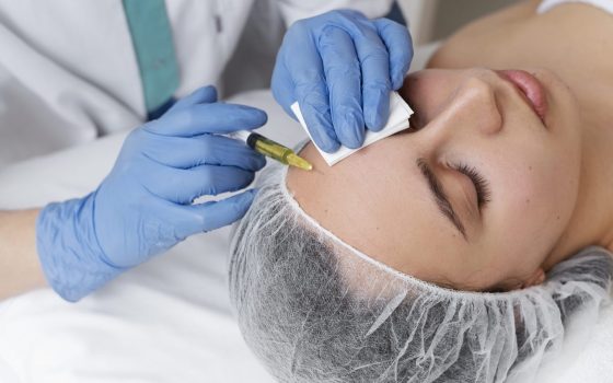 woman getting face prp treatment high angle