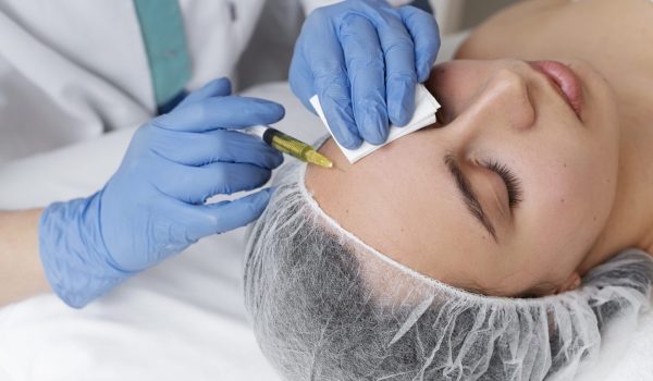 woman getting face prp treatment high angle