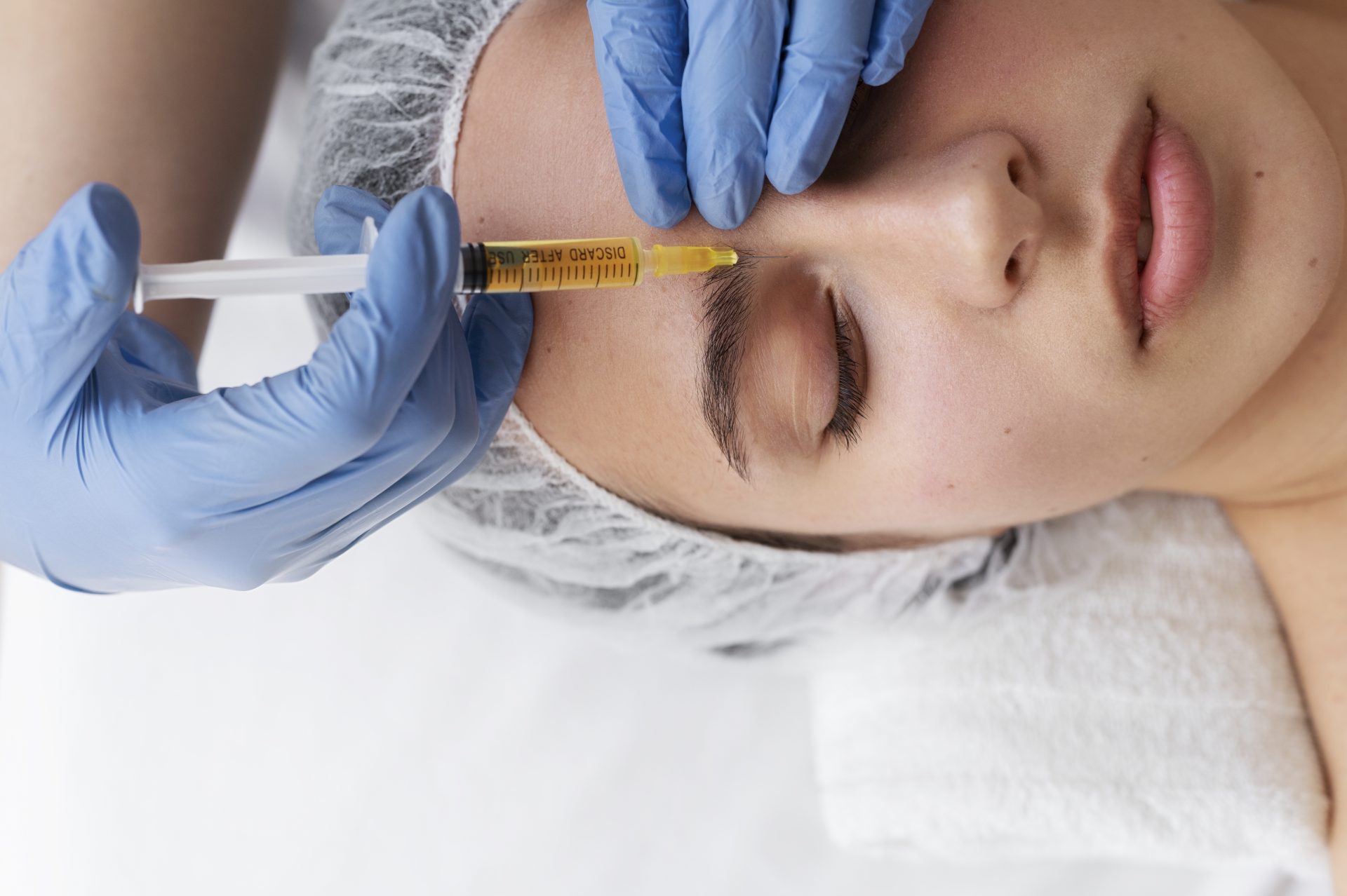 view woman getting face prp treatment